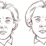 פציאליס טיפול בעזרת רפואה סינית