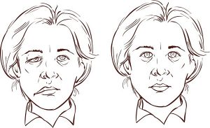 פציאליס טיפול בעזרת רפואה סינית