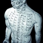 נקודות דיקור