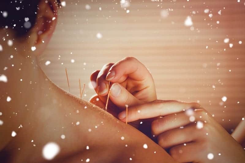 קליניקת דיקור סיני לפוריות